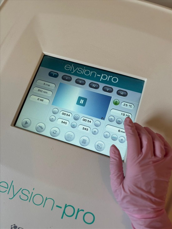 תמונה 2 ,לייזר להסרת שיער Elysion Pro למכירה בחולון ציוד לעסקים  ציוד לקליניקות ומרפאות