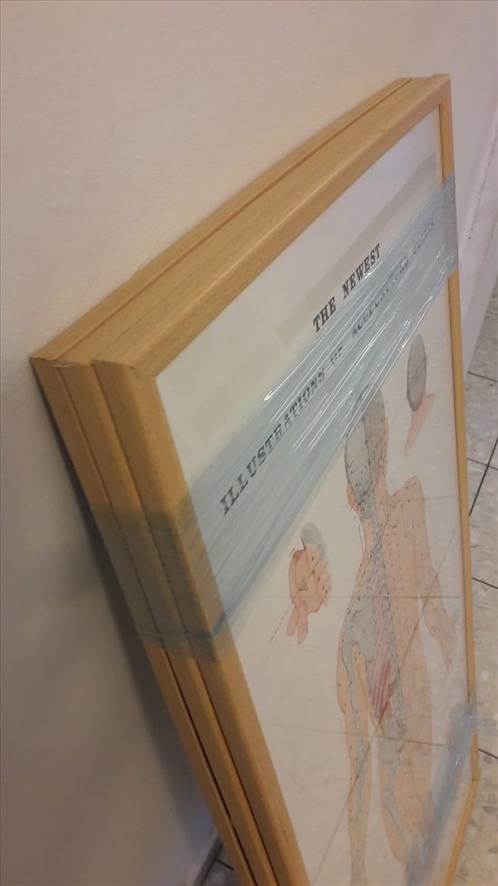 תמונה 1 ,מפות דיקור סיני ממוסגר למכירה ברמת גן אלטרנטיבי  אחר