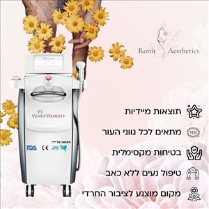 לייזר להסרת שיער 