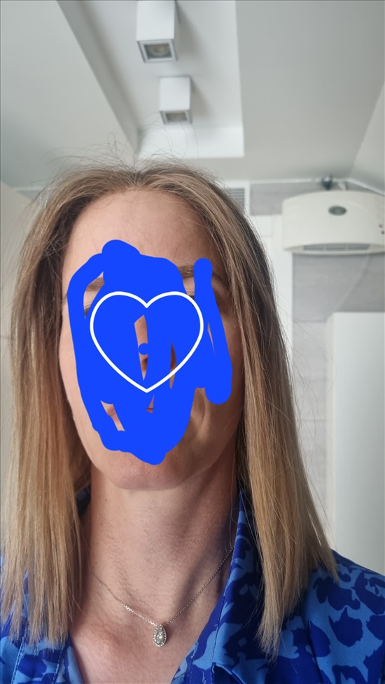תמונה 1 ,פאה טופ לייס מבית איטה פישר למכירה בתל אביב ביגוד ואביזרים  פאות